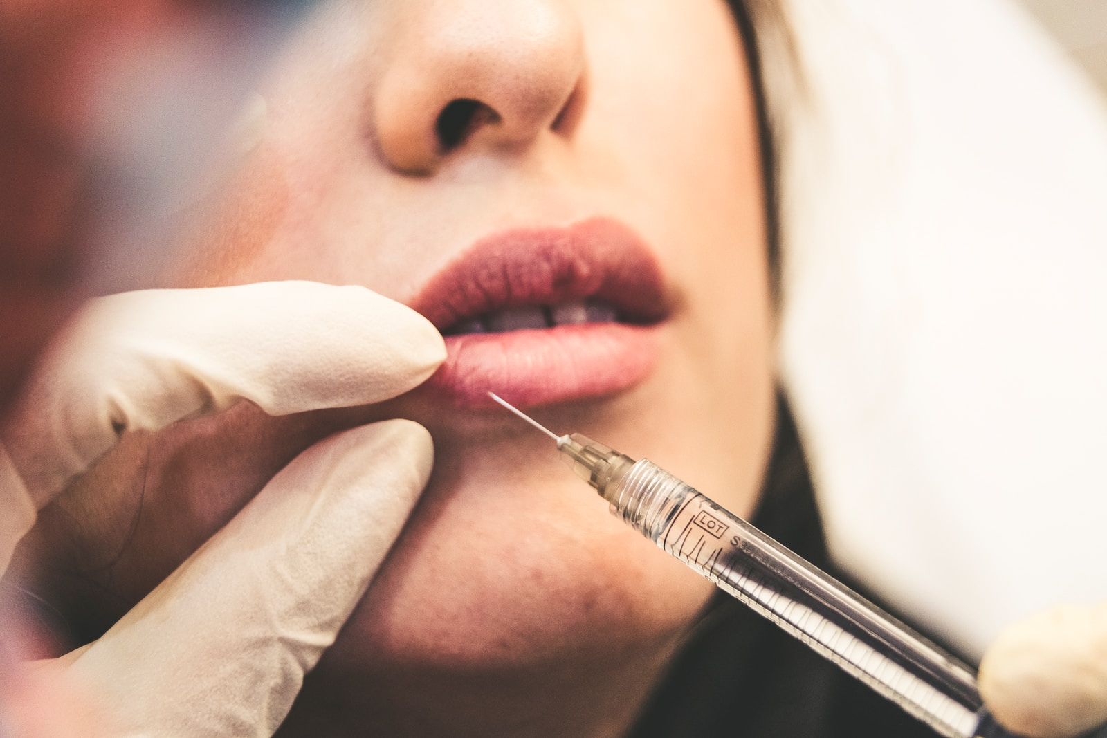 lip filler injections
