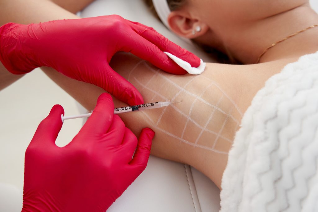 Hyperhidrosis sufferers can reduce sweating with armpit Botox injections.