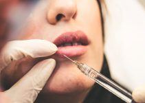 In Minutes, Juvéderm Can Restore the Appearance of Aging Lips