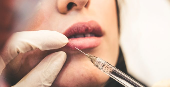 In Minutes, Juvéderm Can Restore the Appearance of Aging Lips In Minutes, Juvéderm Can Restore the Appearance of Aging Lips